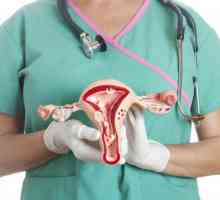 Displazia cervicală: cauze, simptome, diagnostic și tratament