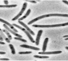 Celulele bacteriene se caracterizează prin prezența a ceea ce? Caracteristicile, structura și…