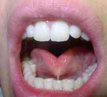 Partea inferioară a cavității orale (anatomie). Cavitatea orală: structura, fiziologia