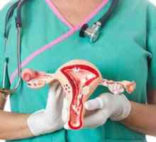 Tumorile benigne ale ovarelor: diagnostic, simptome, tratament