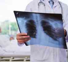 Impartasiti pneumonie: tratament si simptome