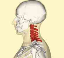 Dorsopatia coloanei vertebrale cervicale: cauze, simptome și caracteristici ale tratamentului