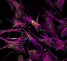 Fibroblastele sunt ce? Reîntinerirea celulară de fibroblaste