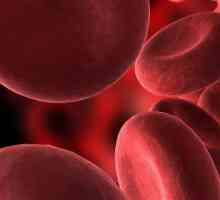 Folic de anemie: cauze, simptome, tratament