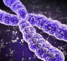 Unde sunt localizate cromozomii? Unde în celulă sunt cromozomii