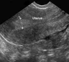 Ultrasunete ginecologice: în ce zi a ciclului, unde să faceți, decodarea