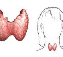 Hipertiroidismul tiroidian: cauze, simptome, diagnostic, tratament