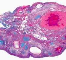 Histologia ovarului: trăsături și funcții