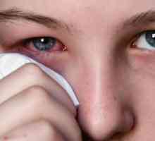 Ochii umflati si mancarimi: cauze si tratament