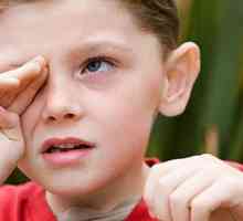 Unguent ocular pentru conjunctivită pentru copii și adulți