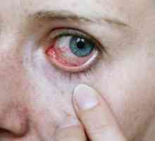 Viermi în ochi: cauze și diagnostice