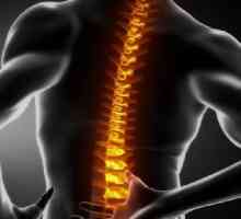 Herniationul coloanei vertebrale lombosacrale: tratament, simptome