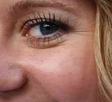 Lamele de gâscă în jurul ochilor: cum să cureți acasă. Crema cu acid hialuronic și colagen