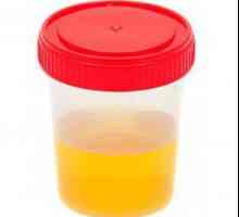 Examenul chimico-toxicologic al urinei
