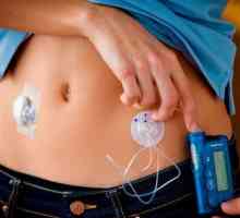 Pompa de insulină - instalare, tipuri, aplicație