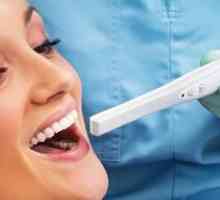 Camere intraorale - asistenți fiabili dentistului