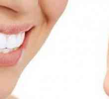 Elainers: recenzii despre kappa pentru alinierea dinților
