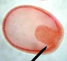 Embriologia este ... Istoria embriologiei