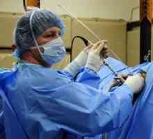 Operații endoscopice: trăsături, avantaje și dezavantaje