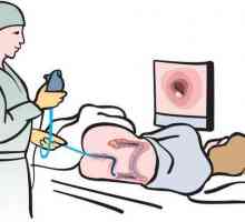 Endoscopia intestinului: ce este, descrierea procedurii, indicații, pregătire