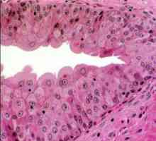 Epileu în urină: cauze și posibile consecințe