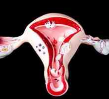 Sângerare uterină juvenilă: cauze, diagnostic diferențial și tratament