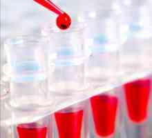 Cum să vă pregătiți pentru livrarea unui test de sânge biochimic? Cum se prepară pentru livrarea de…