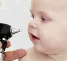 Cum și ce să tratați un nas curbat la copii de 6 luni