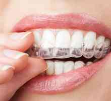 Cum și ce să vă albiți dinții acasă? mijloace