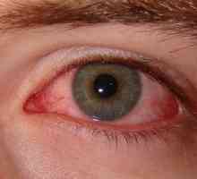 Cum sa scapi de sindromul de ochi uscat?