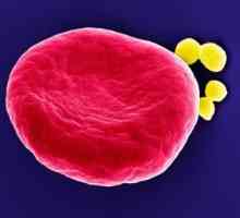 Cum se tratează Staphylococcus prin metode populare