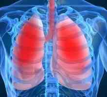 Cum este tratată pneumonia? Recomandări utile