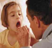 Cum se trateaza laringita la un copil? Alegem o metodă fiabilă