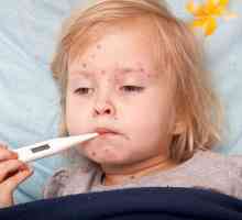 Cum pornește varicela: primele semne, simptome și caracteristici ale tratamentului
