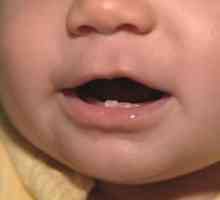 Cum să distingem un dinte de copil de rădăcina unui copil?
