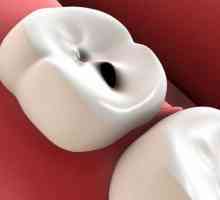 Cum acasă tratați cariile dentare? Remedii populare