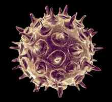 Cum arata varicela? Cauze, simptome și tratament pentru varicela