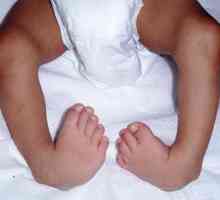 Cum de a vindeca un picior de copii într-un copil? Masaj, Exerciții, Pantofi ortopedici, Operație