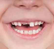 Cum sa rupi un dinte fara durere unui copil acasa?
