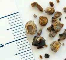 Cum să elimini pietrele din rinichi? Remedii populare și medicamente pentru excreția pietrelor la…