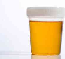 Ce culoare trebuie să aibă urina la o persoană sănătoasă?