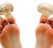 Care doctor tratează ciuperca unghiilor pe picioare - micolog sau dermatolog?