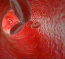 Sângerări capilare: ce este și cum să-l opriți