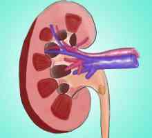 Carbuncle al rinichiului: cauze, simptome, diagnostic, tratament