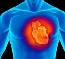 Cardiomiopatia este ... Cardiomiopatia disormală și dismetabolică