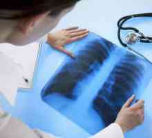 Tuse cu tuberculoză: trăsături și simptome