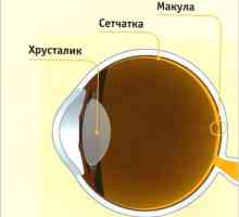 Cataractă: simptome și tratament. Prevenirea cataractei cu remedii folclorice