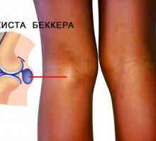 Kick Baker articulație genunchi: semne, diagnostic și tratament