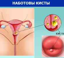 Chistul cervical: simptome și tratament