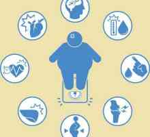 Clasificarea obezității. Cauze, simptome, diagnostic și tratament al obezității